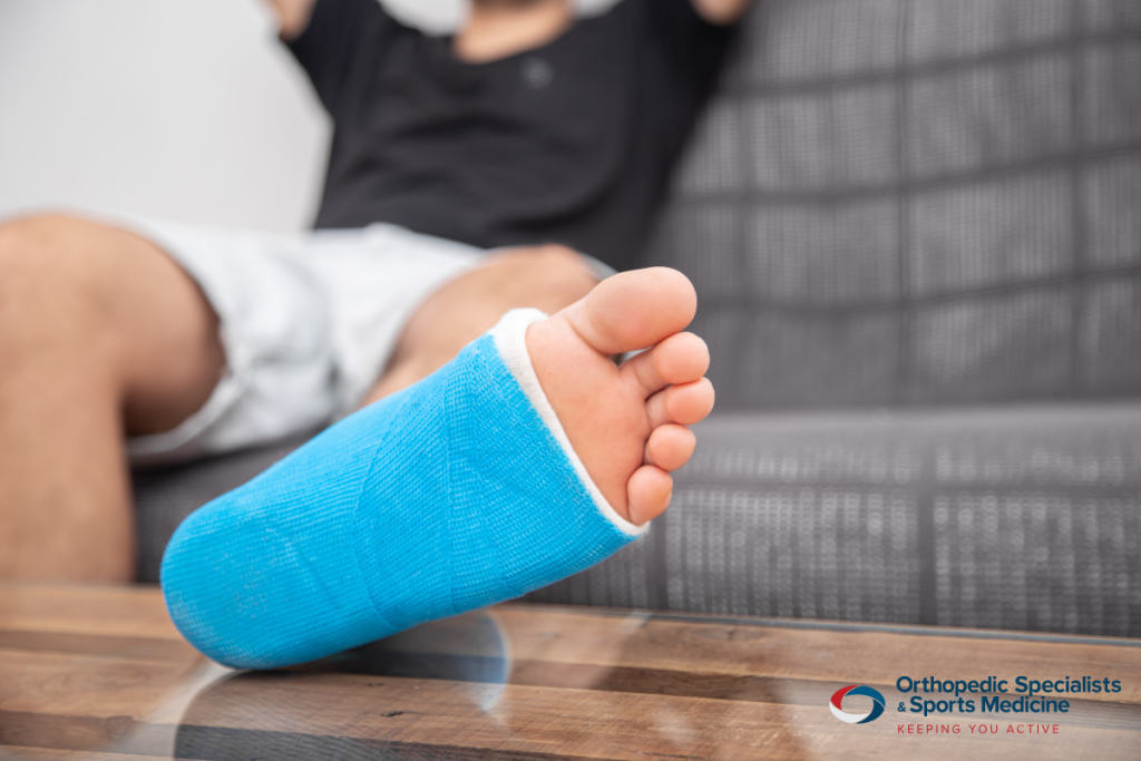 A man’s leg in a cast due to a compound fracture in Ohio.
